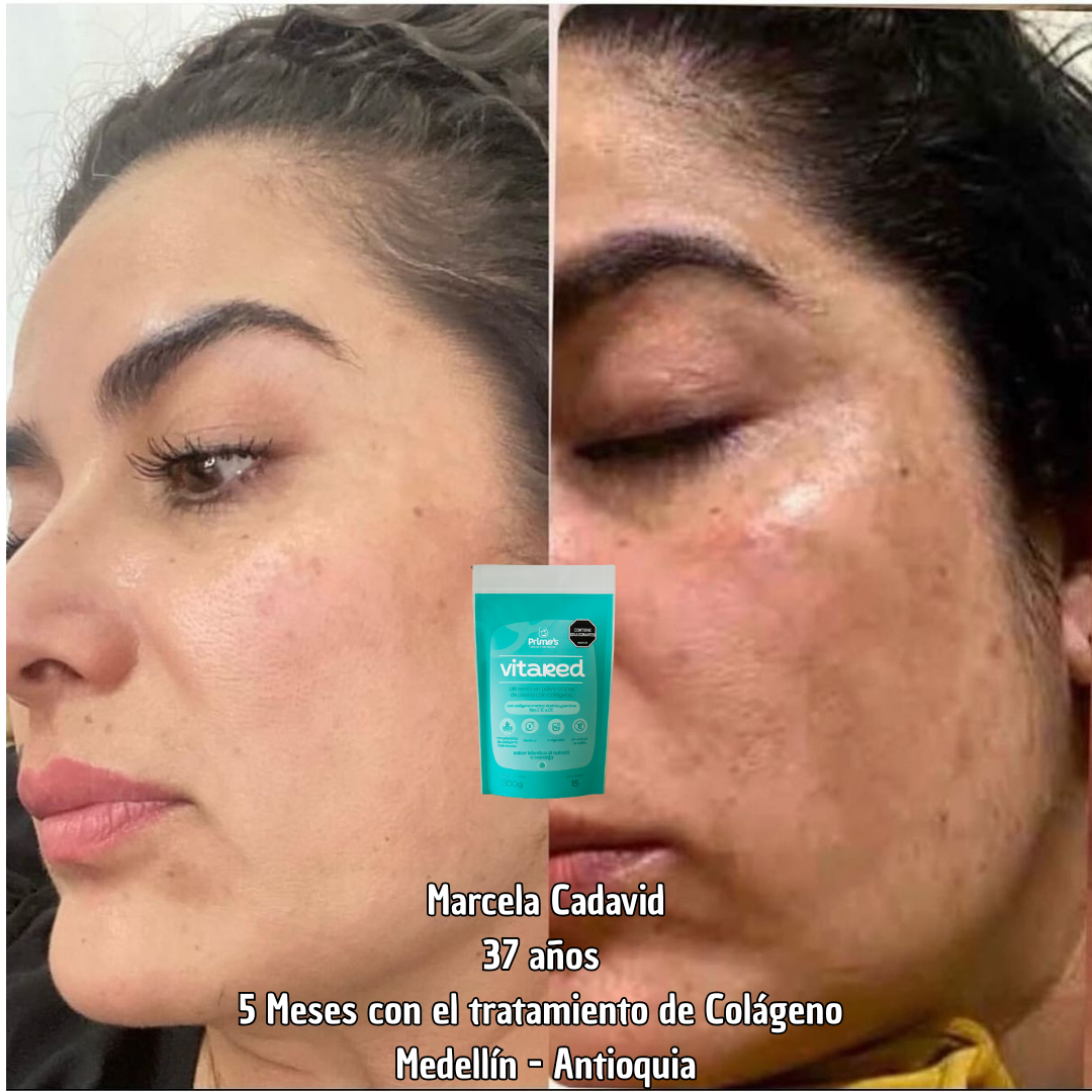 Tratamiento Firmeza y Elasticidad de la Piel - Colageno Marino - Bovino y Porcino. 300g