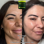 Tratamiento de Rejuvenecimiento Cata - Kor NAD