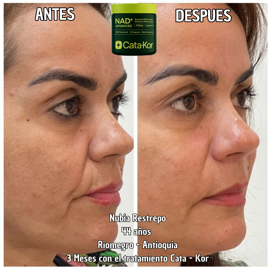 Tratamiento de Rejuvenecimiento Cata - Kor NAD
