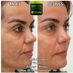 Tratamiento de Rejuvenecimiento Cata - Kor NAD