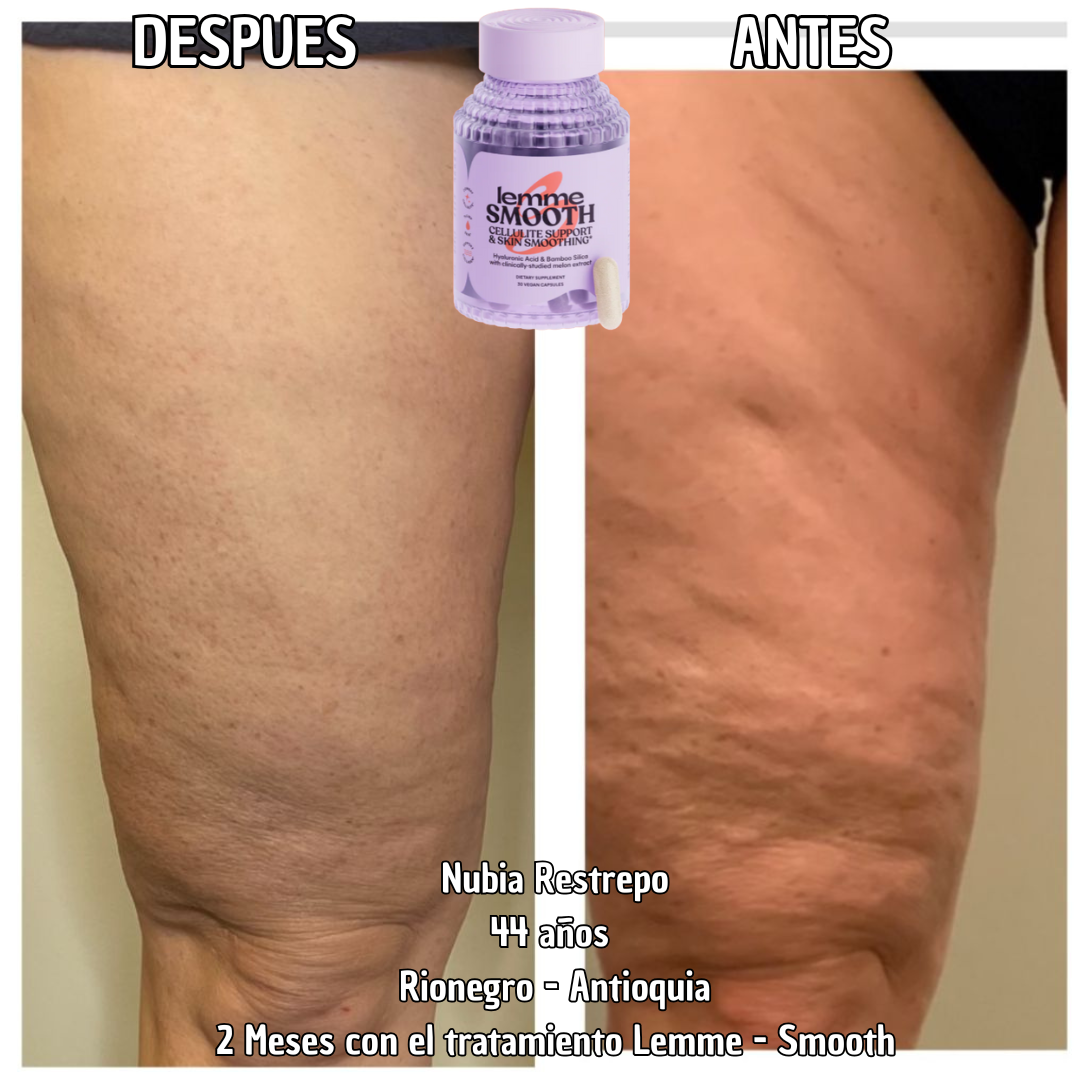 Combate la celulitis - Capsulas de melón Frances Lemme smooth SOD B Dimpless® - 30 capsulas