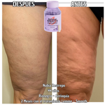 Combate la celulitis - Capsulas de melón Frances Lemme smooth SOD B Dimpless® - 30 capsulas