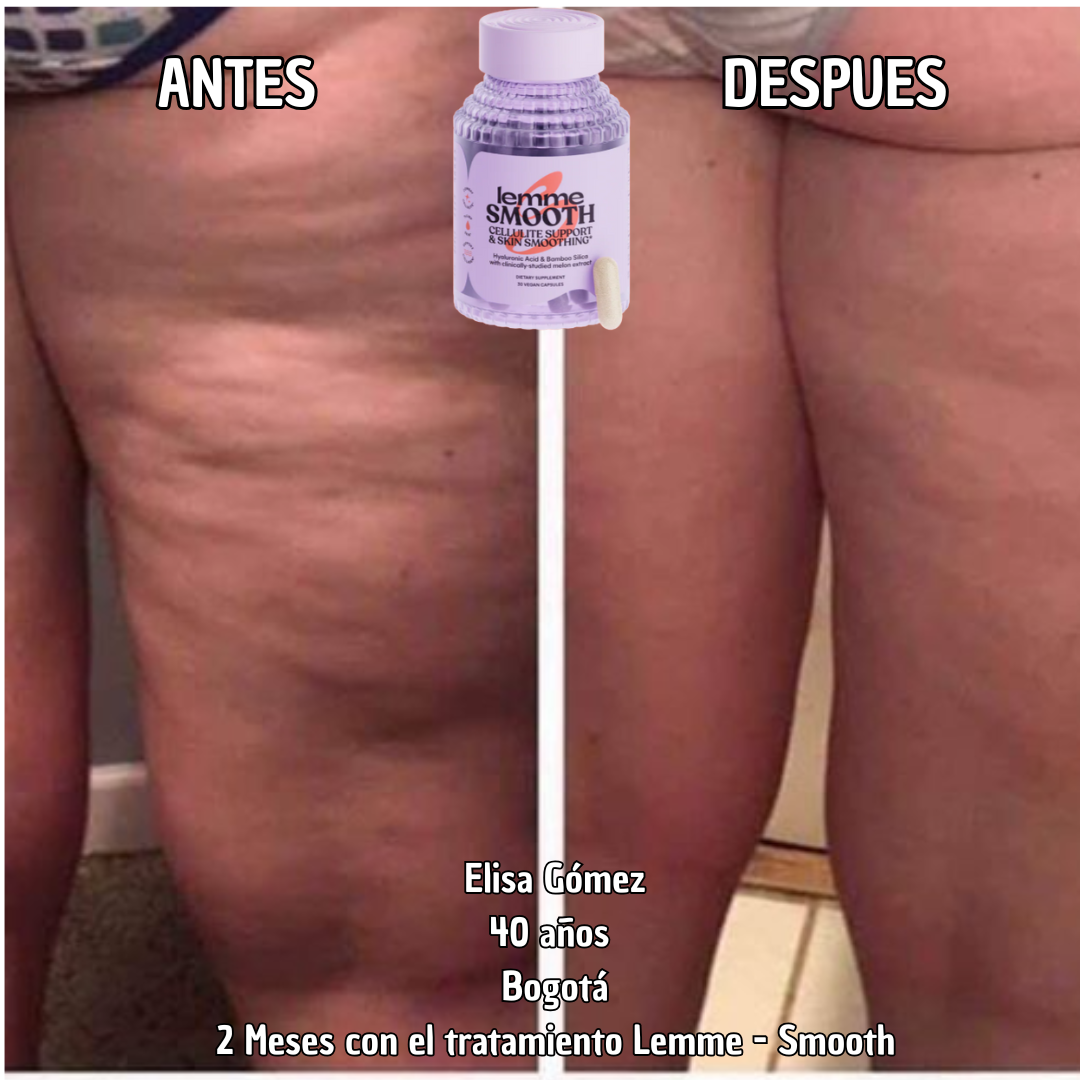 Combate la celulitis - Capsulas de melón Frances Lemme smooth SOD B Dimpless® - 30 capsulas