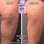 Combate la celulitis - Capsulas de melón Frances Lemme smooth SOD B Dimpless® - 30 capsulas