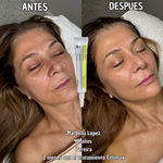 Celimax Retinal A-Shot™: el secreto clínico para una piel más joven y elástica