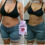 Lemme Burn - Quemador de grasa - Despierta tu AMPK natural y dile adiós a la grasa abdominal