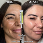 Celimax Retinal A-Shot™: el secreto clínico para una piel más joven y elástica