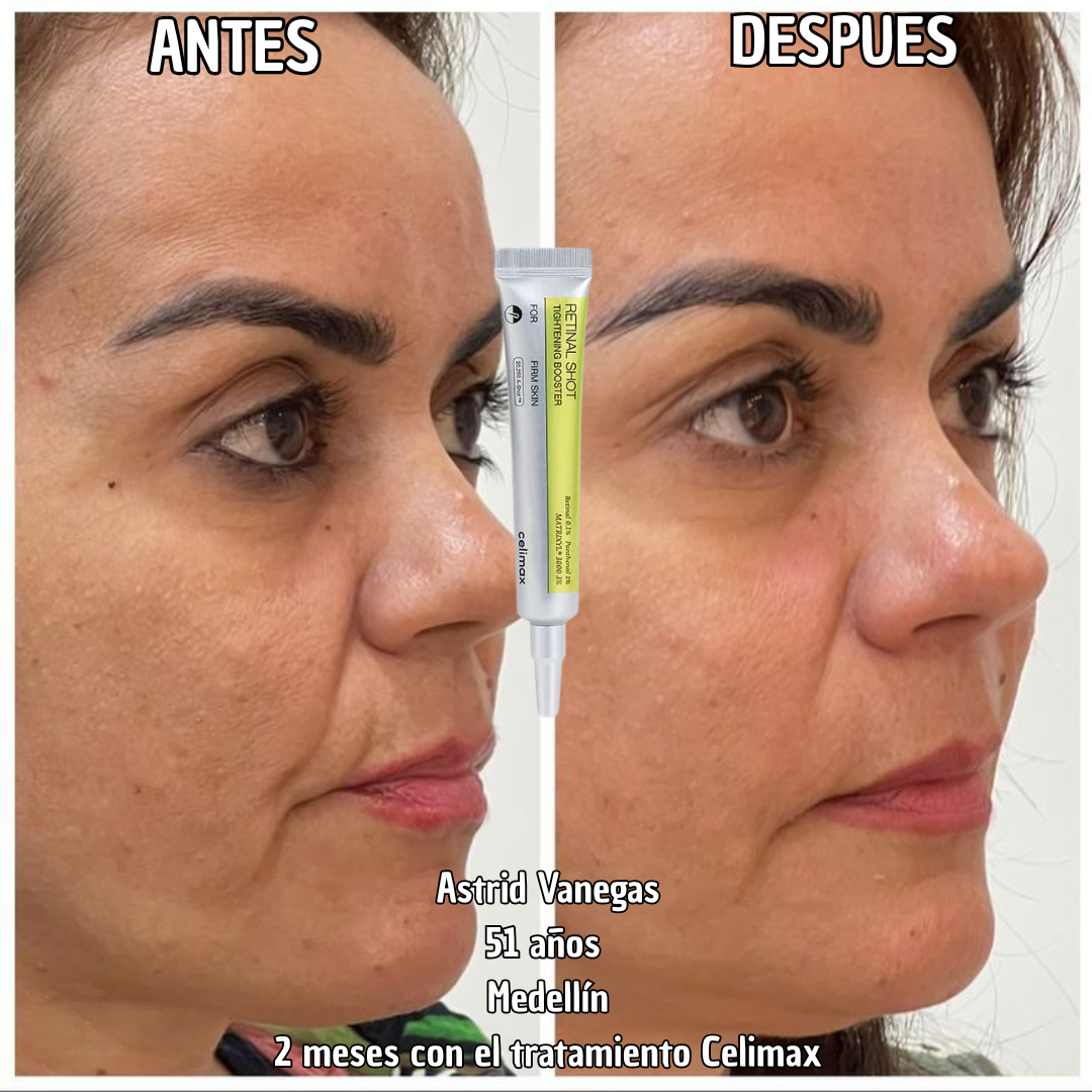 Celimax Retinal A-Shot™: el secreto clínico para una piel más joven y elástica