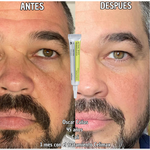 Celimax Retinal A-Shot™: el secreto clínico para una piel más joven y elástica