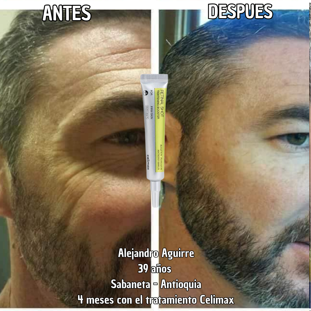 Celimax Retinal A-Shot™: el secreto clínico para una piel más joven y elástica