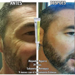 Celimax Retinal A-Shot™: el secreto clínico para una piel más joven y elástica