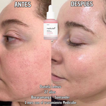 Serum Coreano de Salmón Medicube – PDRN REGENERATIVE