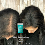 Tratamiento Firmeza y Elasticidad de la Piel - Colageno Marino - Bovino y Porcino. 300g