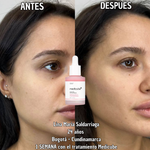 Serum Coreano de Salmón Medicube – PDRN REGENERATIVE