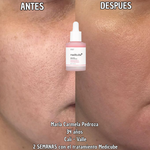 Serum Coreano de Salmón Medicube – PDRN REGENERATIVE