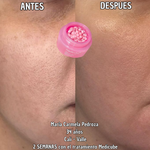 Crema Medicube con Cápsulas de PDRN (ADN de Salmón)