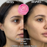 Crema Medicube con Cápsulas de PDRN (ADN de Salmón)