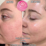 Crema Medicube con Cápsulas de PDRN (ADN de Salmón)