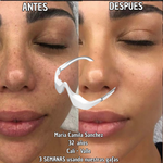 Gafas Terapia Luz Roja & Microcorriente EMS – Reduce Ojeras, Bolsas y Fatiga Ocular