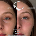 Gafas Terapia Luz Roja & Microcorriente EMS – Reduce Ojeras, Bolsas y Fatiga Ocular