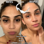 Gafas Terapia Luz Roja & Microcorriente EMS – Reduce Ojeras, Bolsas y Fatiga Ocular