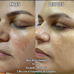 Tratamiento Firmeza y Elasticidad de la Piel - Colageno Marino - Bovino y Porcino. 300g