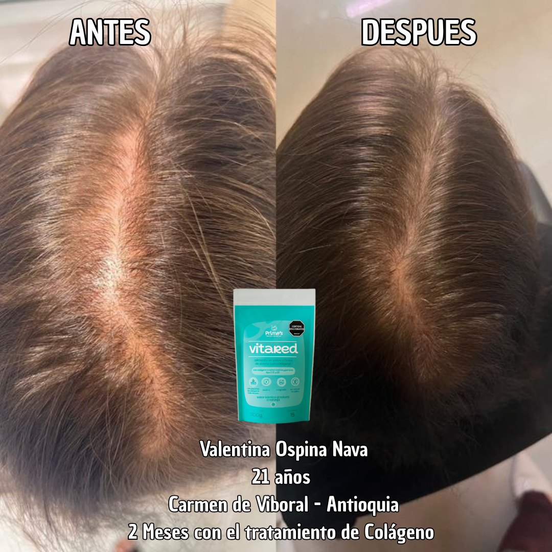 Tratamiento Firmeza y Elasticidad de la Piel - Colageno Marino - Bovino y Porcino. 300g