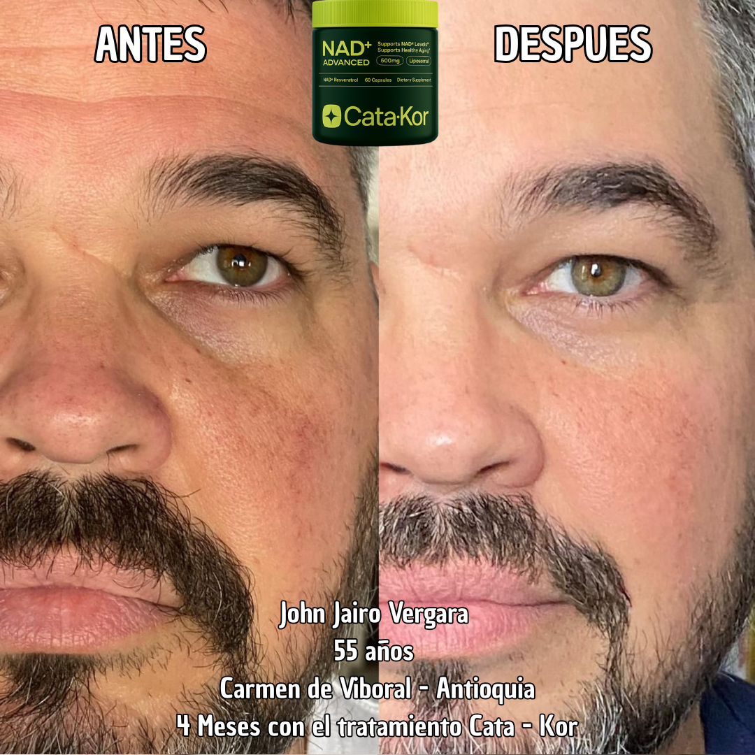 Tratamiento de Rejuvenecimiento Cata - Kor NAD