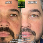 Tratamiento de Rejuvenecimiento Cata - Kor NAD