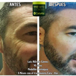 Tratamiento de Rejuvenecimiento Cata - Kor NAD