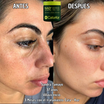 Tratamiento de Rejuvenecimiento Cata - Kor NAD