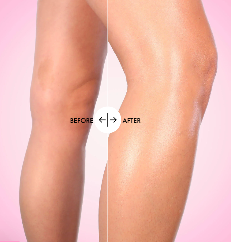 Truly Soft – Piel Suave y Sin Irritación - Despigmentante - Suavizante - Aclarante