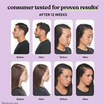 Lemme Grow Original® – Suplemento Capilar Oficial de la Marca de las Kardashian | Crecimiento y Fortalecimiento del Cabello