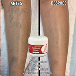 ¡OFERTA 2 x 1! VARICOSE VEINS PROFESIONAL (ORIGINAL) – Recupera la Belleza y Ligereza de Tus Piernas