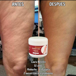 ¡OFERTA 2 x 1! VARICOSE VEINS PROFESIONAL (ORIGINAL) – Recupera la Belleza y Ligereza de Tus Piernas