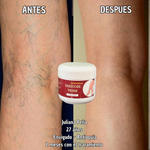¡OFERTA 2 x 1! VARICOSE VEINS PROFESIONAL (ORIGINAL) – Recupera la Belleza y Ligereza de Tus Piernas