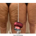 SMART CUPPING PRO™ Masajeador Inteligente de Bienestar y Cuidado Corporal