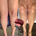 SMART CUPPING PRO™ Masajeador Inteligente de Bienestar y Cuidado Corporal