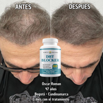 DHT BLOCKER 60 Capsulas - Actúa ahora antes de que la caída de tu cabello avance.