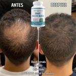 DHT BLOCKER 60 Capsulas - Actúa ahora antes de que la caída de tu cabello avance.