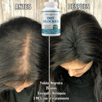 DHT BLOCKER 60 Capsulas - Actúa ahora antes de que la caída de tu cabello avance.