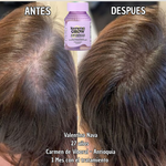 Lemme Grow Original® – Suplemento Capilar Oficial de la Marca de las Kardashian | Crecimiento y Fortalecimiento del Cabello