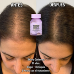 Lemme Grow Original® – Suplemento Capilar Oficial de la Marca de las Kardashian | Crecimiento y Fortalecimiento del Cabello