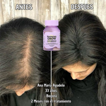 Lemme Grow Original® – Suplemento Capilar Oficial de la Marca de las Kardashian | Crecimiento y Fortalecimiento del Cabello