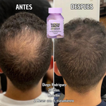 Lemme Grow Original® – Suplemento Capilar Oficial de la Marca de las Kardashian | Crecimiento y Fortalecimiento del Cabello