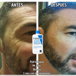 Crema Antiarrugas de Alta Eficacia  - Fubsta Advanced 120 ML