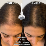 Derma Stamp – Activa Colágeno y Reactiva tu Cabello - Terapia Microagujas