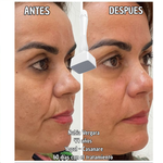 Derma Stamp – Activa Colágeno y Reactiva tu Cabello - Terapia Microagujas
