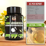 Stone Dissolver CHANCAPIEDRA - Solución Natural para la Eliminación de Cálculos