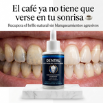 Sérum Dental Remineralizante TrueRelief | Tratamiento con Nanohidroxiapatita, Teobromina y Nano Plata | Fortalece el Esmalte y Reduce la Sensibilidad | 60 ml con Gotero